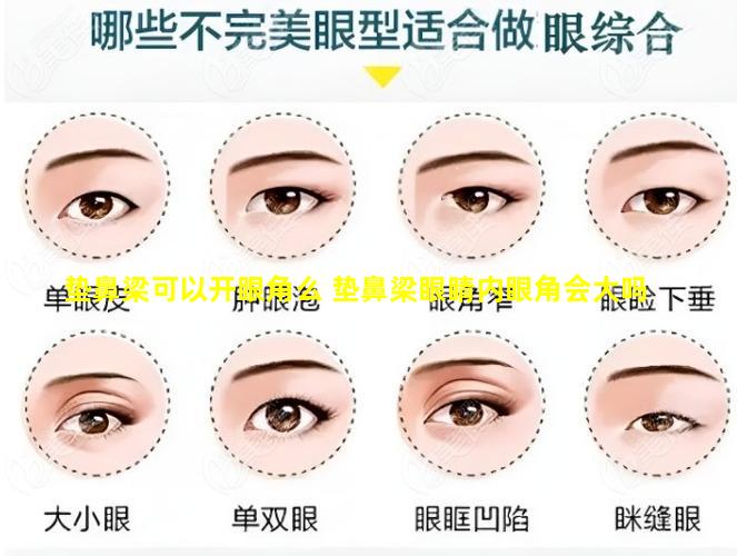 垫鼻梁可以开眼角么 垫鼻梁眼睛内眼角会大吗